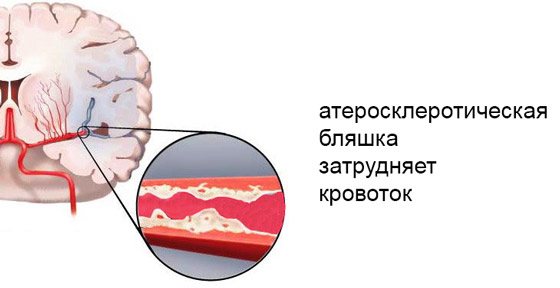 Мр картина очаговых изменений вещества мозга дистрофического характера что это