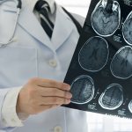 Ангиома головного мозга лечение в Германии