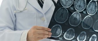 Ангиома головного мозга лечение в Германии