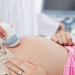 аномалии развития нервной трубки у плода