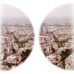 Битемпоральная гемианопсия