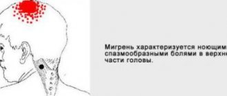 Болит голова в одной точке при надавливании. Кластерная боль