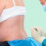 Болит спина после эпидуральной анестезии причины лечение