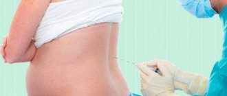 Back pain after epidural anesthesia causes treatment