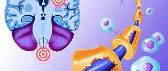 Demyelinating brain disease