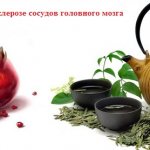 Диета при атеросклерозе сосудов головного мозга