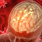 Дисциркуляторная энцефалопатия - Лето