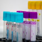 длительность фармакотерапии