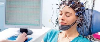 Electroencephalography (EEG)