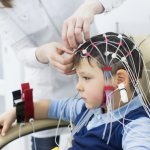 Электроэнцефалография мозга.