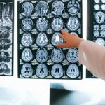 Энцефалопатия смешанного типа - Лето