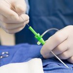 Эндоваскулярная операция