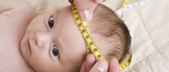 Hydrocephalus