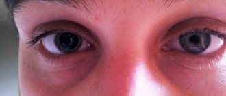 Eyes