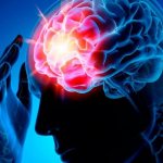 Инсульт левой стороны. Последствия и лечение