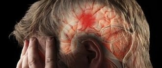 Image 1 Restoring motor skills after a stroke - Verimed