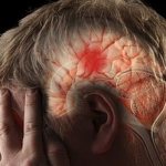 Изображение 1 Восстановление моторики после инсульта - Веримед