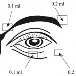 Клонический гемифациальный спазм