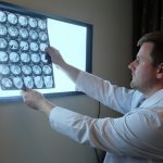 КТ головного мозга