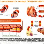 treatment of vascular atherosclerosis with folk remedies with a glass of boiling water
