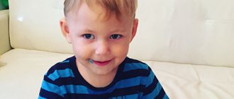 Лечение инфантильных спазмов (синдрома Веста) в Германии