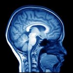 liquorodynamic disorders