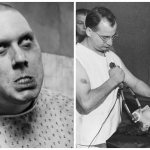 Lobotomy: a little history and scary photos
