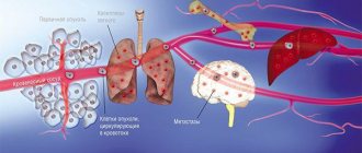 Tumor metastases