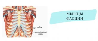 Межреберная невралгия
