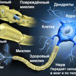 миелинизация демиелинизация диагностика