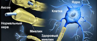 миелинизация демиелинизация диагностика