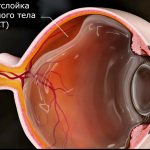 Молнии перед глазами опасны или нет