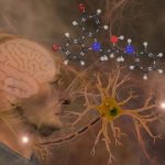 мозг при слабоумии