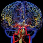 мрт сосудов головного мозга