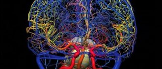 MRI of cerebral vessels