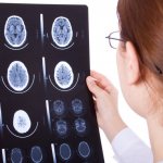 Наружная гидроцефалия головного мозга у взрослого