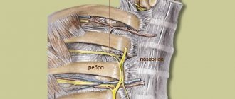 The nerves passing between the ribs cause intercostal neuralgia when they are compressed and inflamed