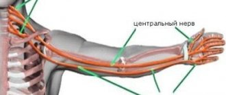 Неврит плечевого нерва: что это такое?