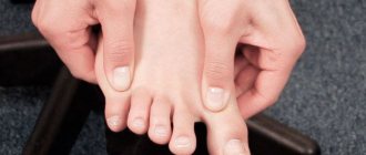 неврома мортона причины