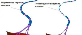 Normal and damaged neuron