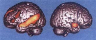 Brain regions activated when searching for a letter in a connected text (left), compared to perceiving an unrelated sequence of words (right)