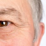 Очаг воспаления при ретробульбарном неврите находится на глазнице