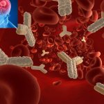 neuromyelitis optica