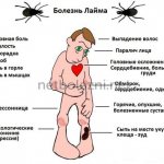Осложнения клещевого боррелиоза
