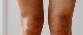 Отказ ног при алкоголизме: способы лечения - Веримед