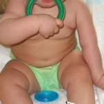 Паралич Дюшена-Эрба