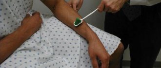 патологические рефлексы