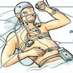 Polysomnography is the most accurate and informative method for studying sleep disorders