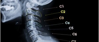 Vertebrae.jpg