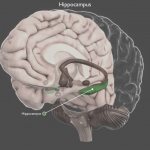 Причины и виды склероза гиппокампа